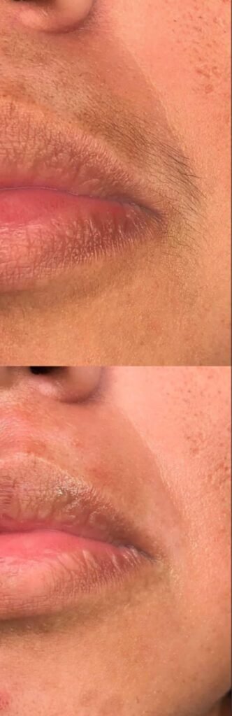 Image #1 from Nisha Saxena