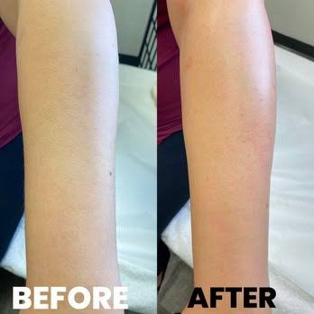 Image #1 from Rashi jain