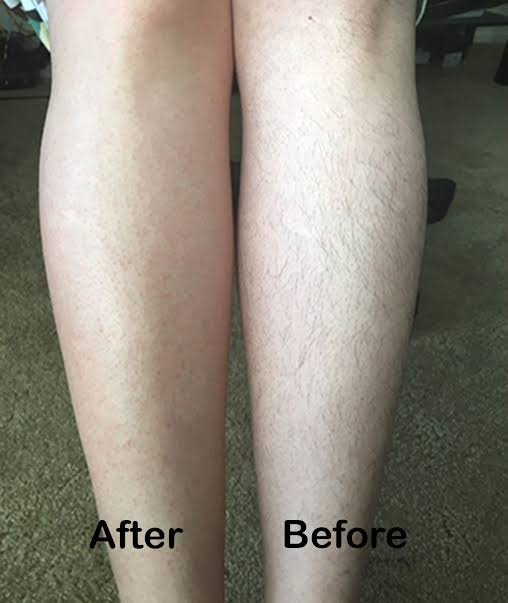 Image #1 from Anaya Chauhan